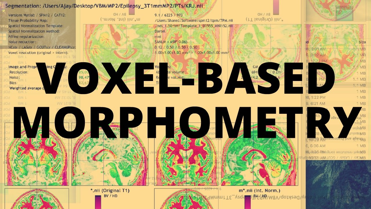 Voxel-based Morphometry (VBM)