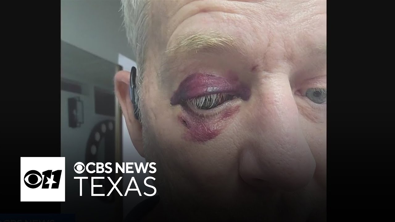 Dallas interior designer attacked outside Richardson restaurant
