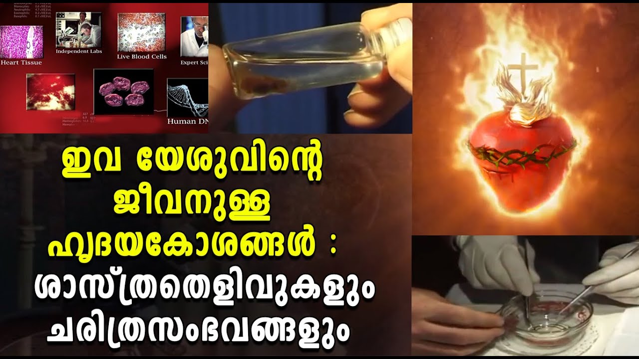 ഇവ യേശുവിന്റെ ജീവനുള്ള ഹൃദയകോശങ്ങള്‍ : ശാസ്ത്രതെളിവുകളും ചരിത്രസംഭവങ്ങളും | Shekinah News