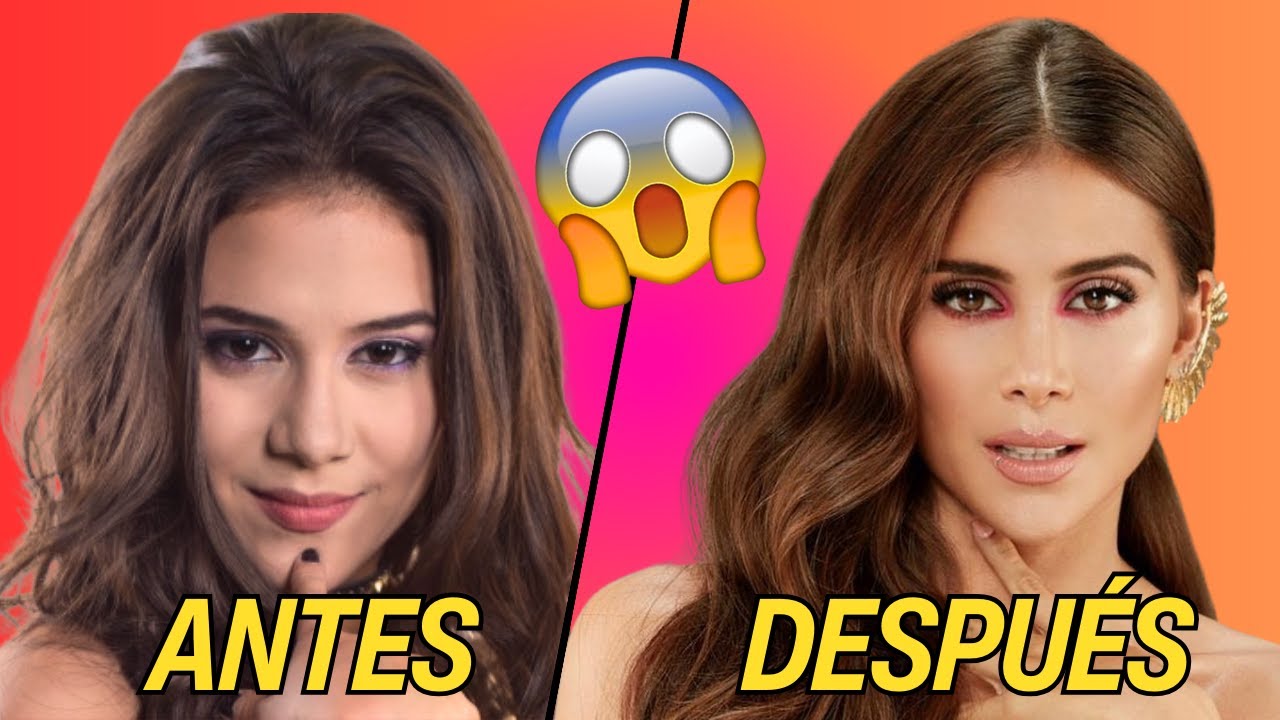 GREEICY RENDÓN | ANTES Y DESPUÉS ¿DE QUÉ SE OPERÓ?