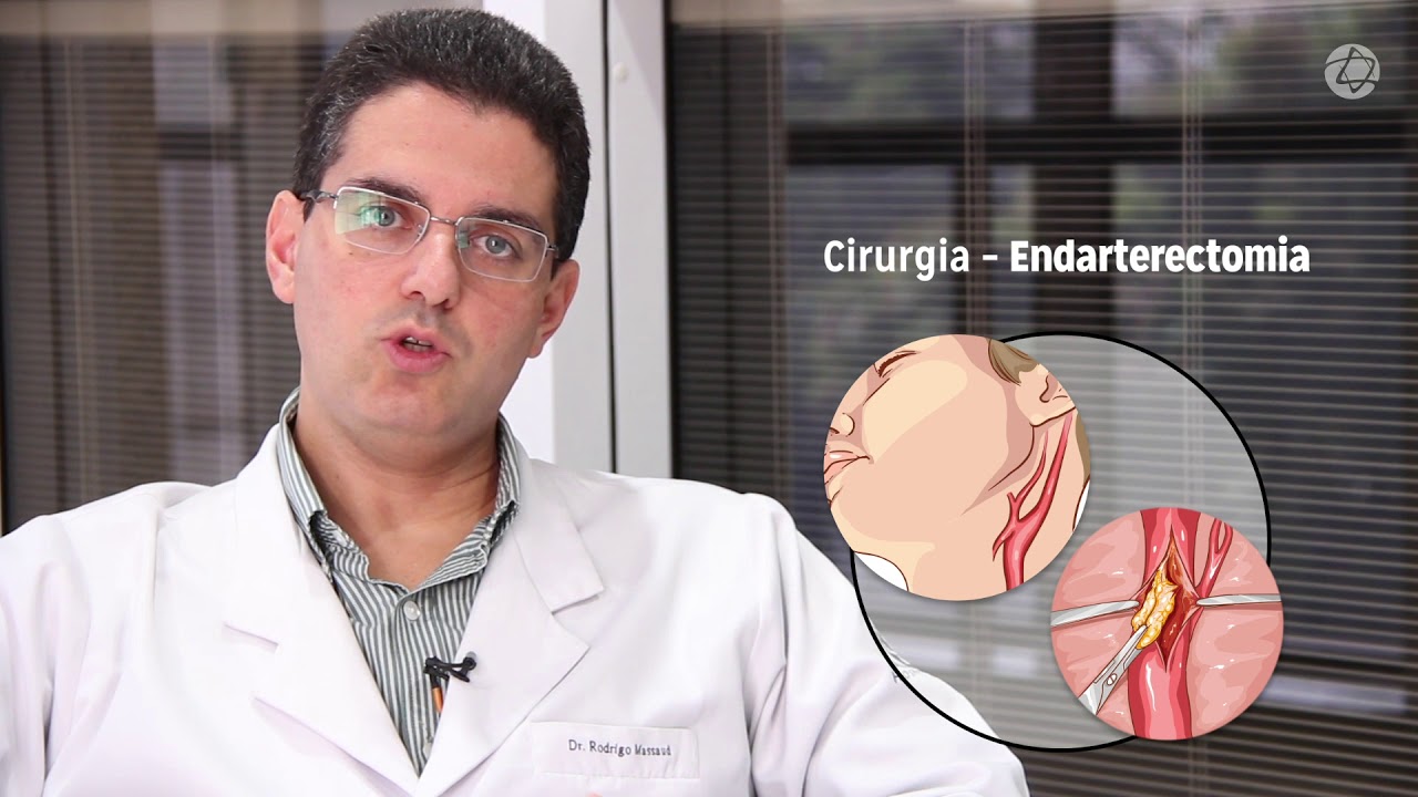 Doen&ccedil;a ateroscler&oacute;tica carot&iacute;dea