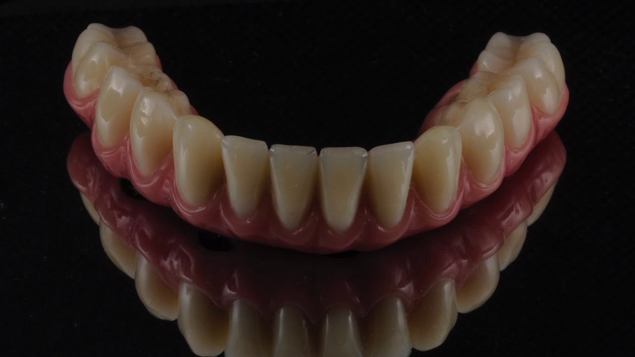 Before & After Dental Implant Treatment At Brighton Implant Clinic
