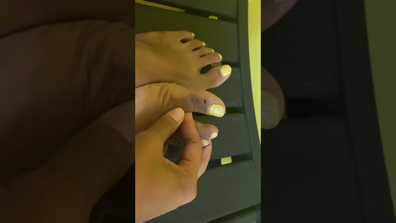 Post gym feet!