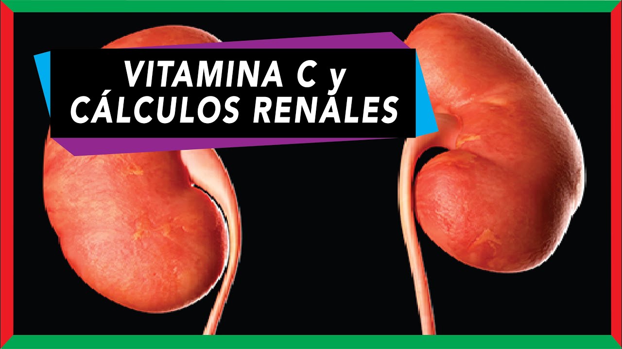 Exceso de vitamina C y cálculos renales – ¿Mito o Verdad?