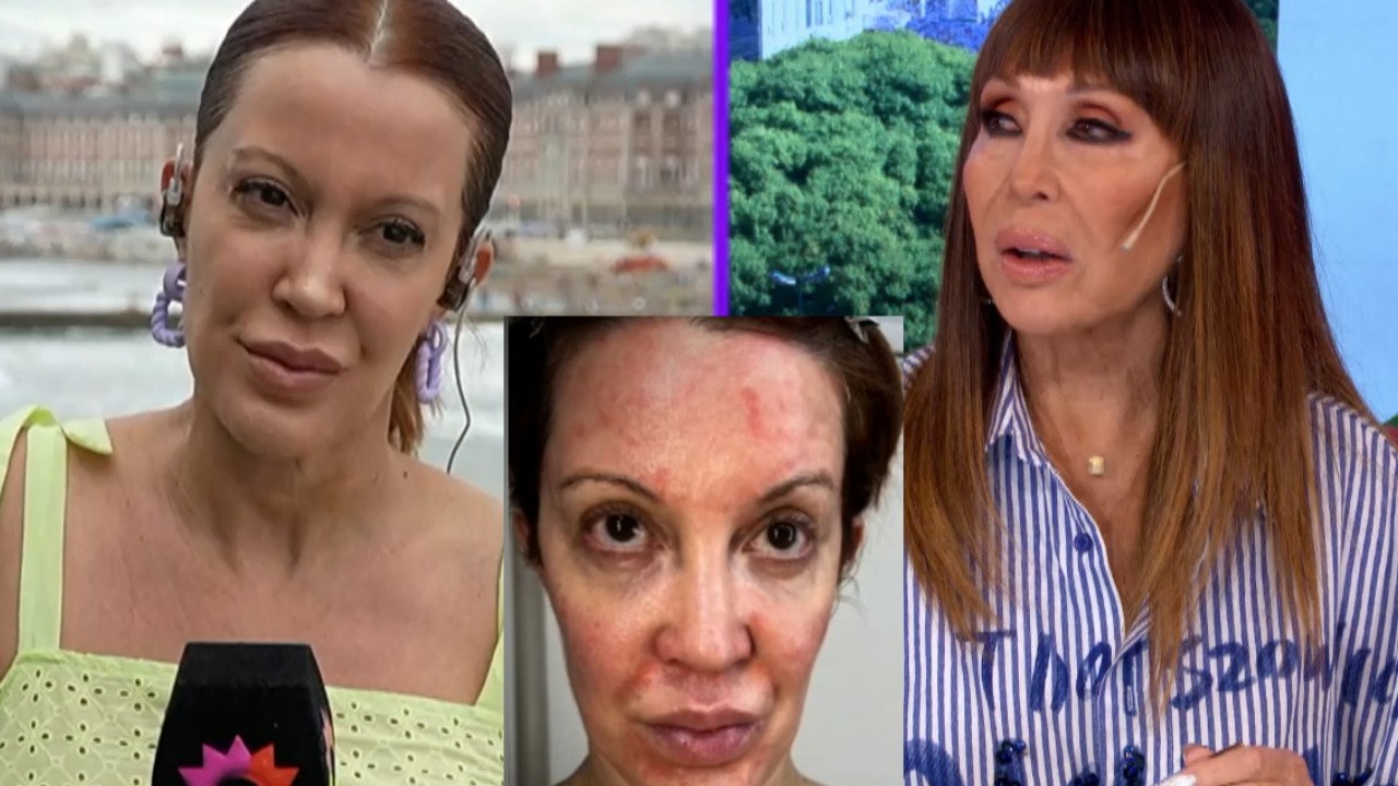 Miriam Lanzoni lucha contra su enfermedad: 