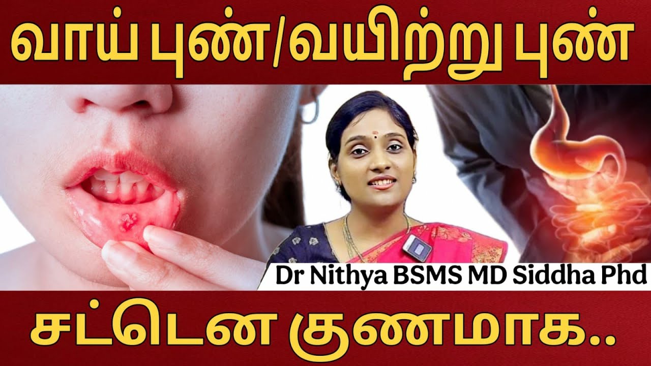 வாய் புண், வயிற்று புண், குடல் புண், இரைப்பை புண் விரைவில் குணமாக இதை சாப்பிட்டால் போதும் / Ulcers