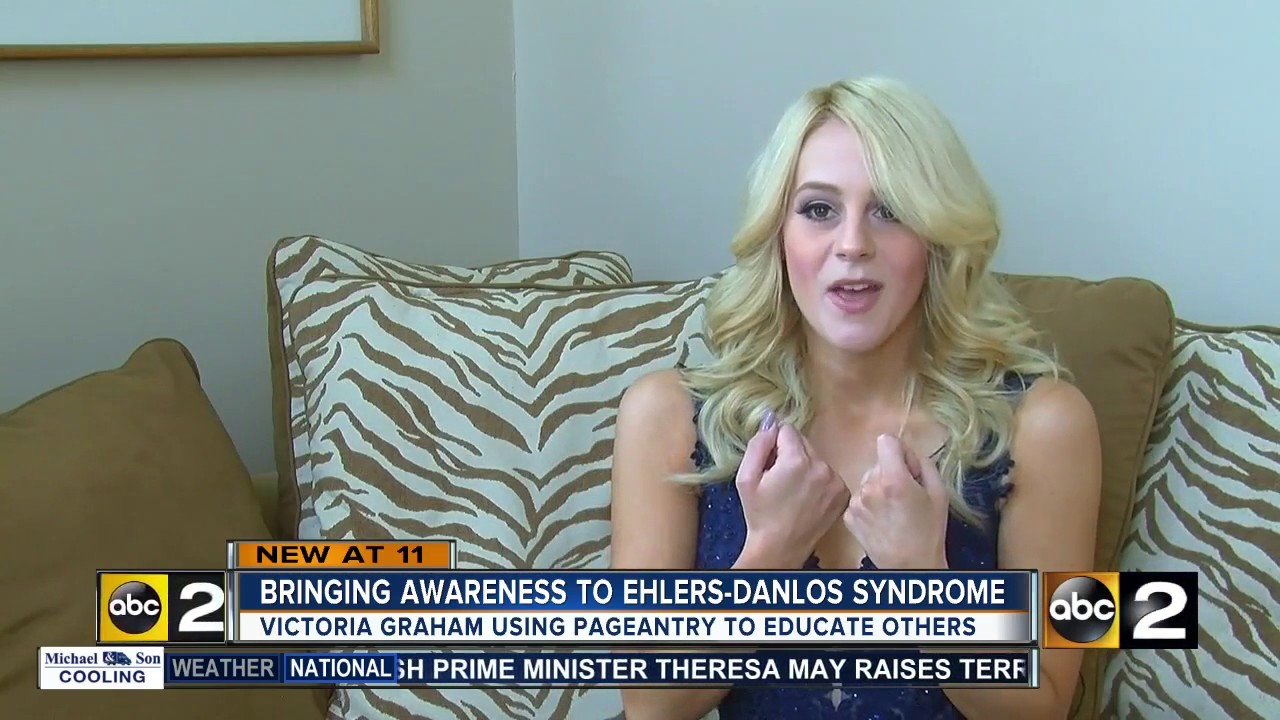 Miss Maryland contestant using pageants to spread awareness about Ehlers-Danlos Syndrome