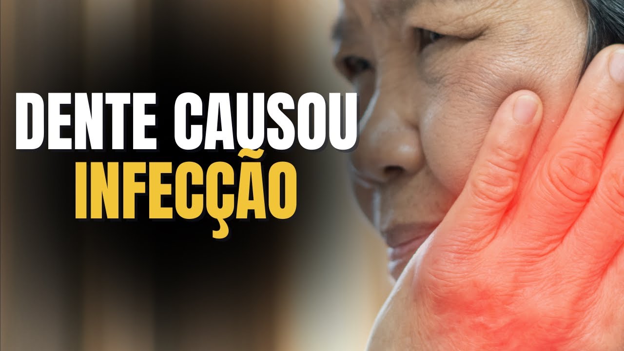 Como TRATAR  rosto inchado com PROBLEMAS DENTÁRIOS