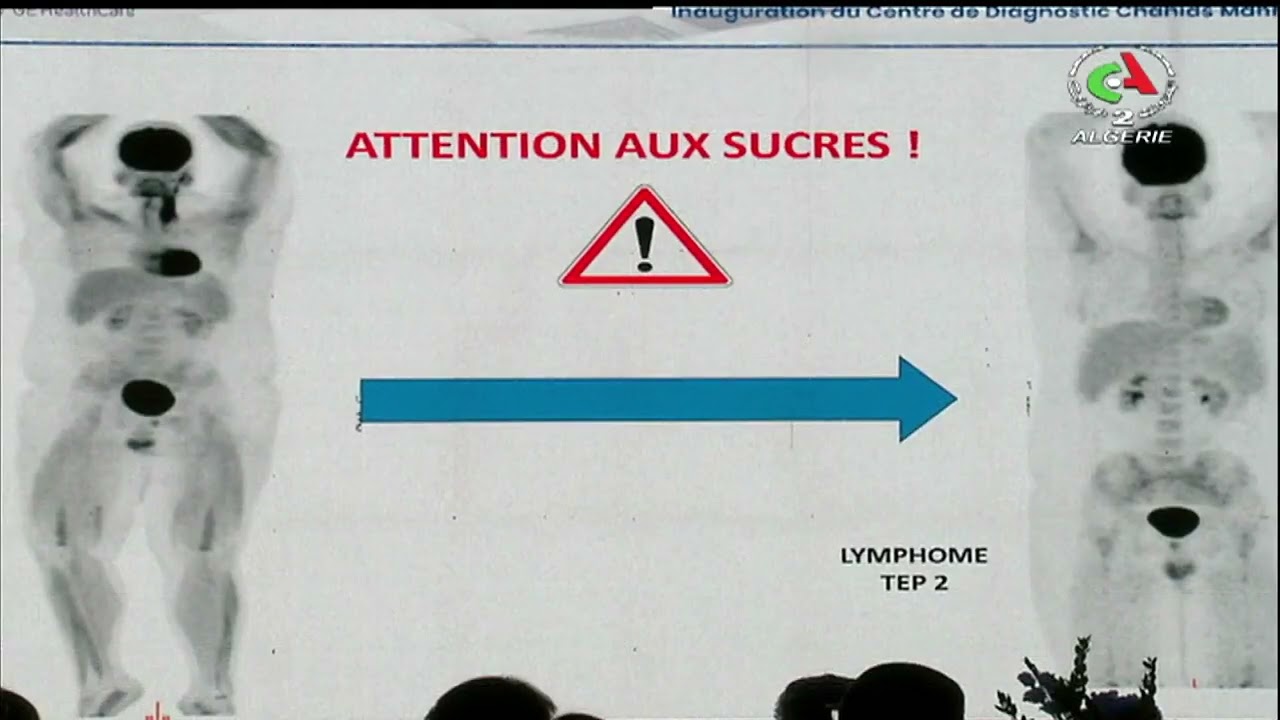 L'Algérie premier pays en Afrique à acquérir le Pet MR scan