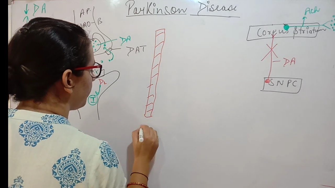 PARKINSON'S  DISEASE | TREATMENT | ANTI-PARKINSON'S DRUGS