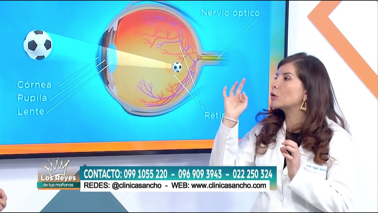 Astigmatismo y Miopía ¿se puede curar? | Dra. Ligia Sancho
