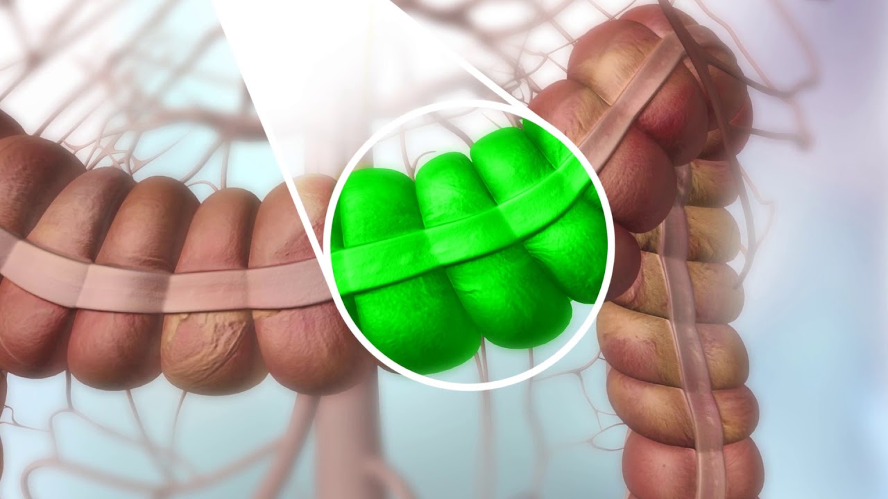 The Benefits of ICG Imaging in Surgery