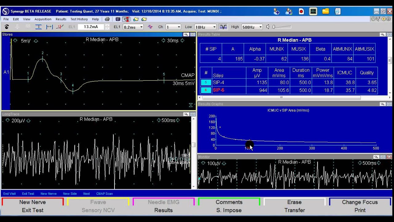 Synergy MUNIX Demo
