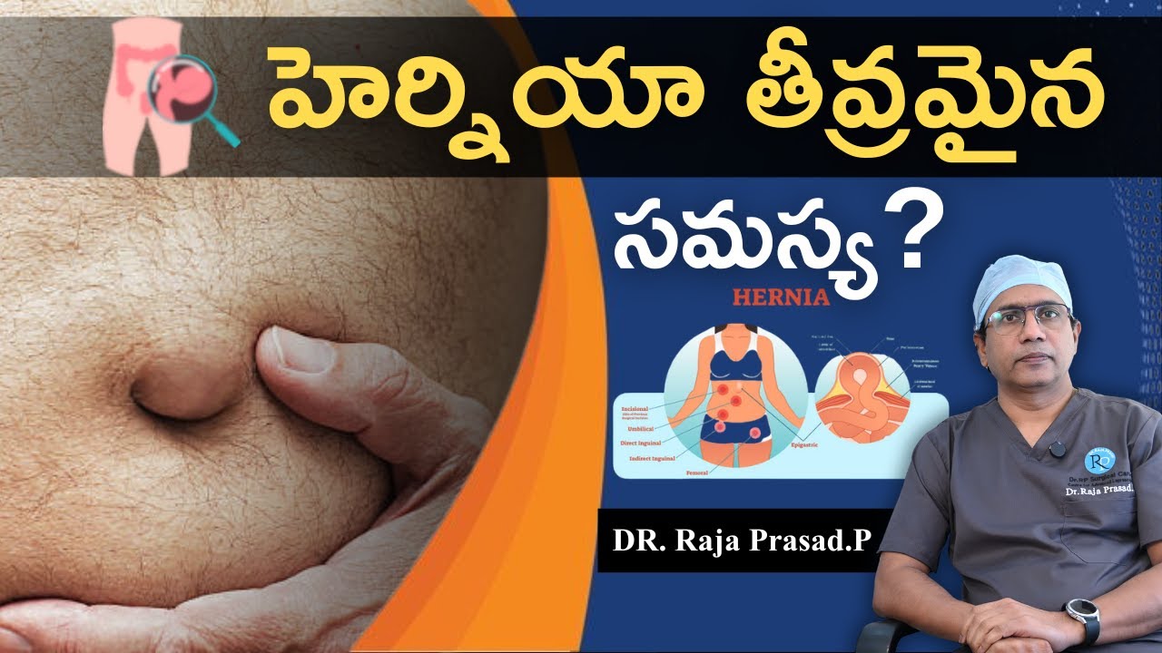 హెర్నియా యొక్క రకాలు & చికిత్స || DR. Raja Prasad.P