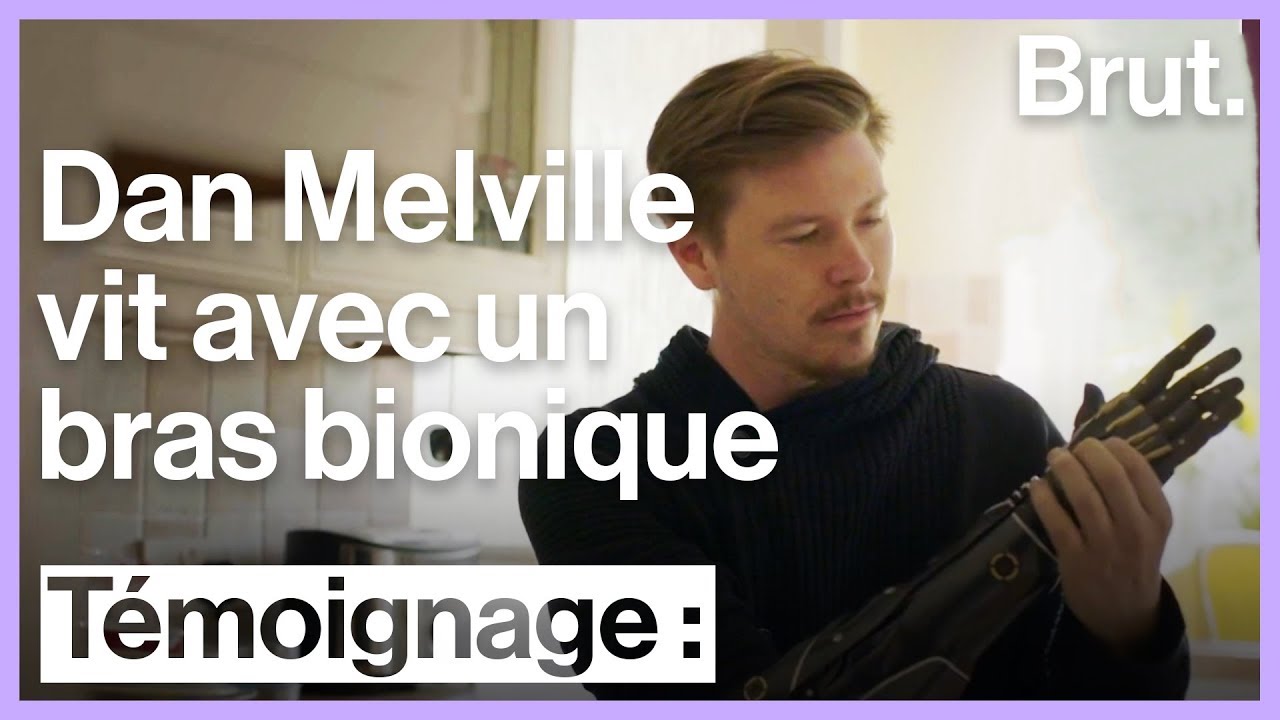 Né sans bras droit, Dan Melville a un bras bionique