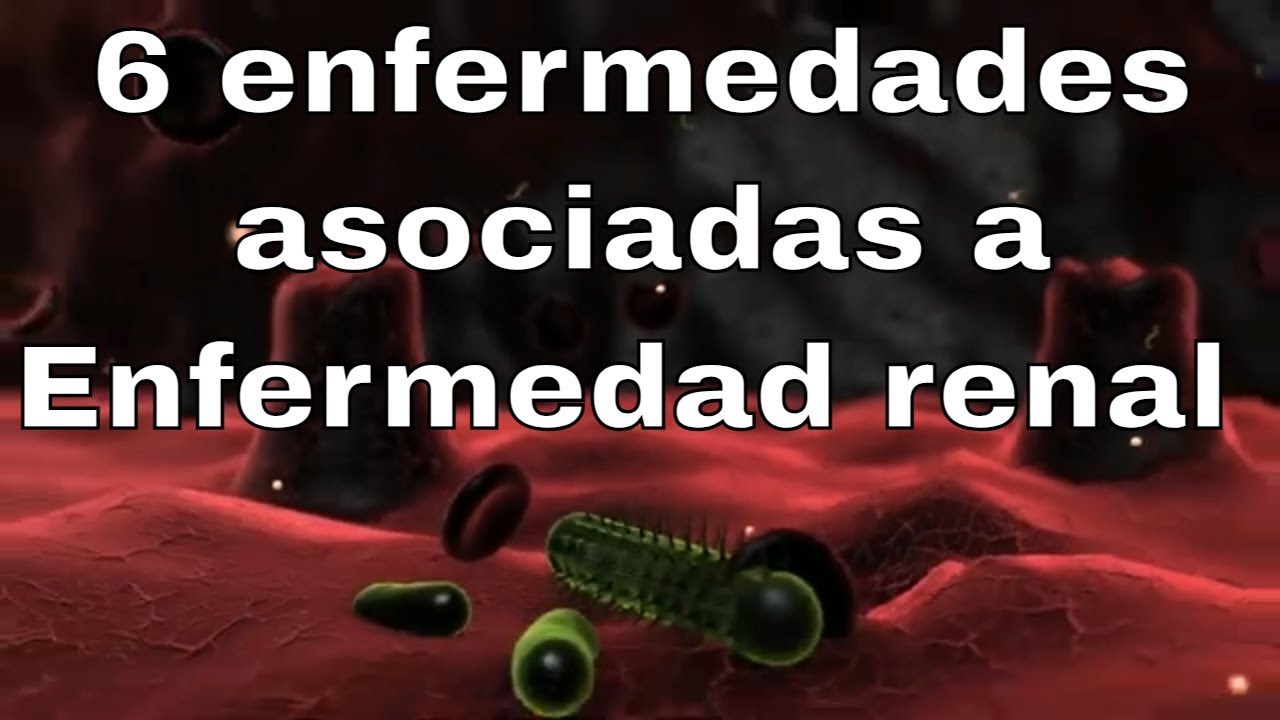 6 enfermedades asociadas con la insuficiencia renal