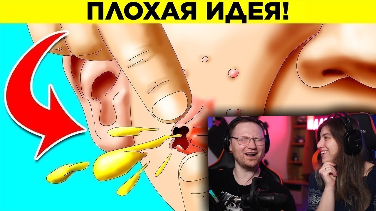 Почему нельзя выдавливать прыщи? Парад Фактов 17 | РЕАКЦИЯ на WTFакт