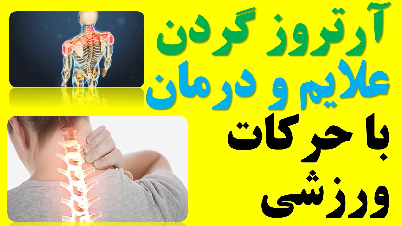 آرتروز گردن تشخیص و درمان طبیعی با حرکات ورزشی