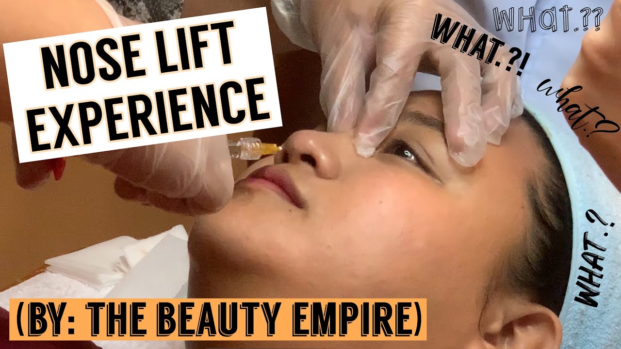 My Nose Lift Experience (by: The Beauty Empire) || Glorissa Mae