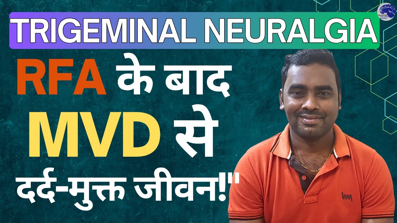 Beating Trigeminal Neuralgia How MVD Surgery CHANGED My Life