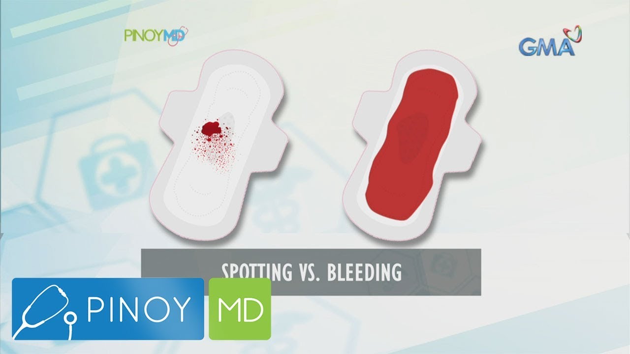 Pinoy MD: Ano nga ba ang abnormal uterine bleeding?