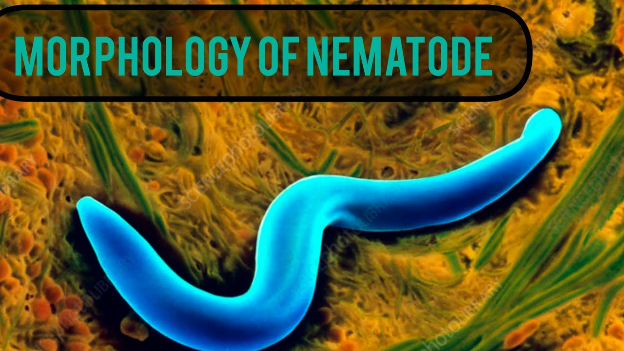Morphology of nematode (Introductory Nematology)#agriculture #nematology #video #competitiveexams 
