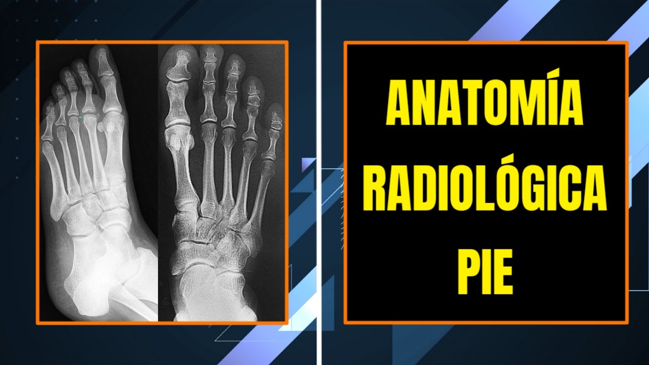 Anatomía Radiológica del Pie (AP, Lateral y Oblicua) Explicada Paso a Paso ⚡