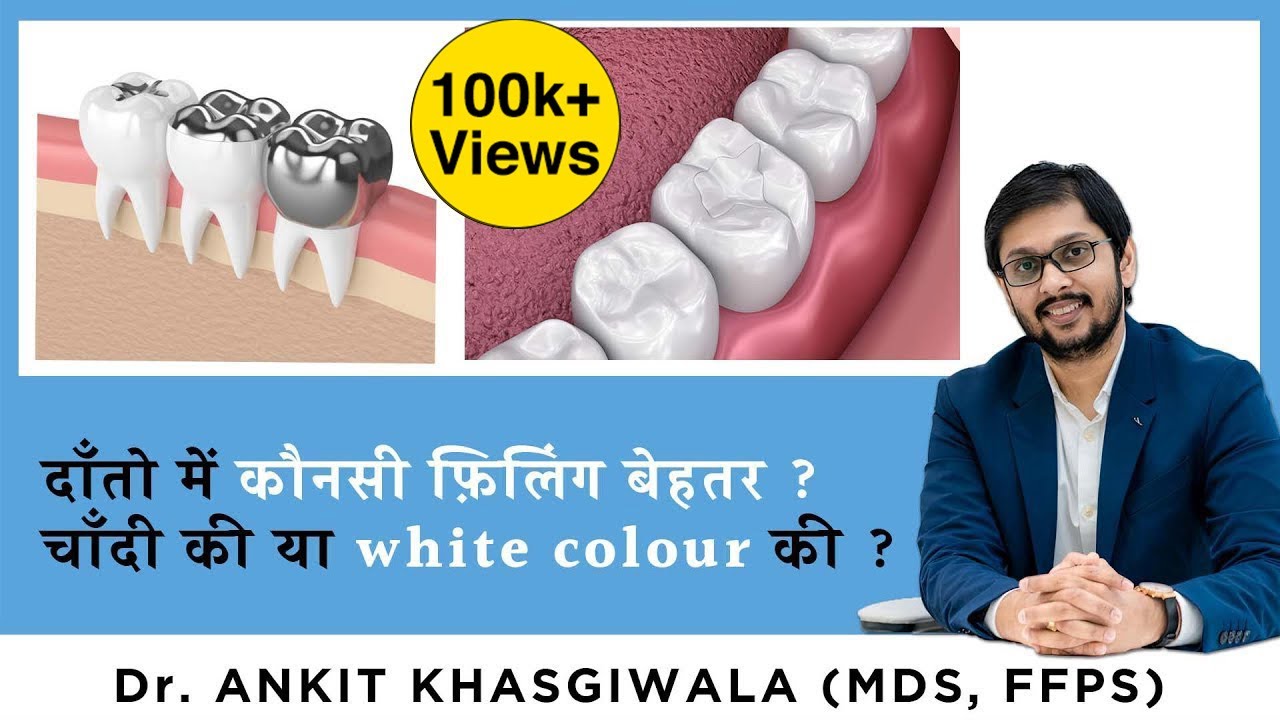 Silver Amalgam vs Composite Filling l चांदी या Composite कौन सा है बेहतर? Tooth Filling Material