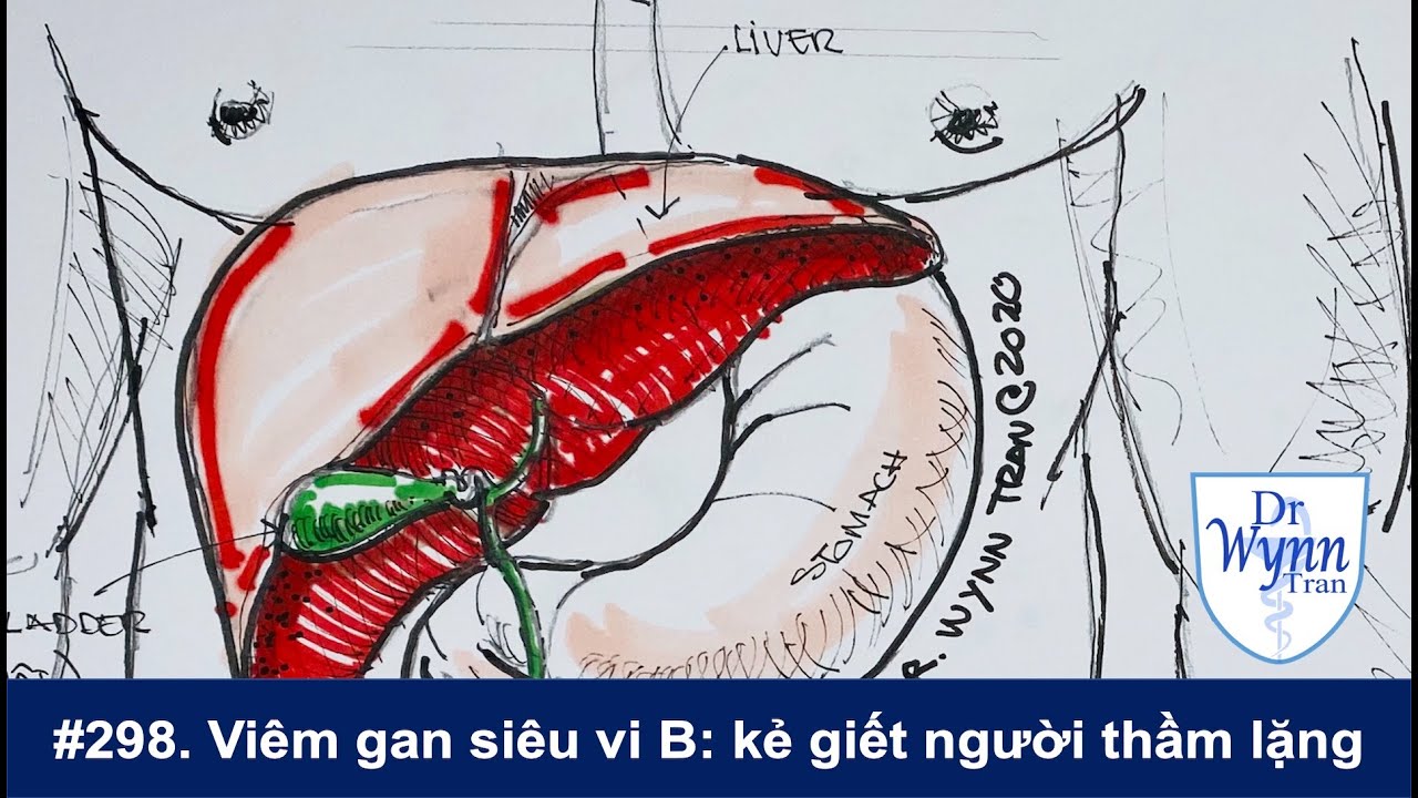 #298. Vi&ecirc;m gan si&ecirc;u vi B: kẻ giết người thầm lặng