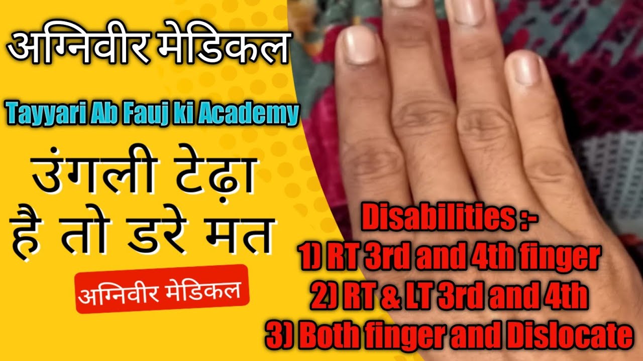 अग्निवीर में उंगली को कैसे चेक किया गया || Agniveer Indian Army Finger Medical Check Up || SSC GD...