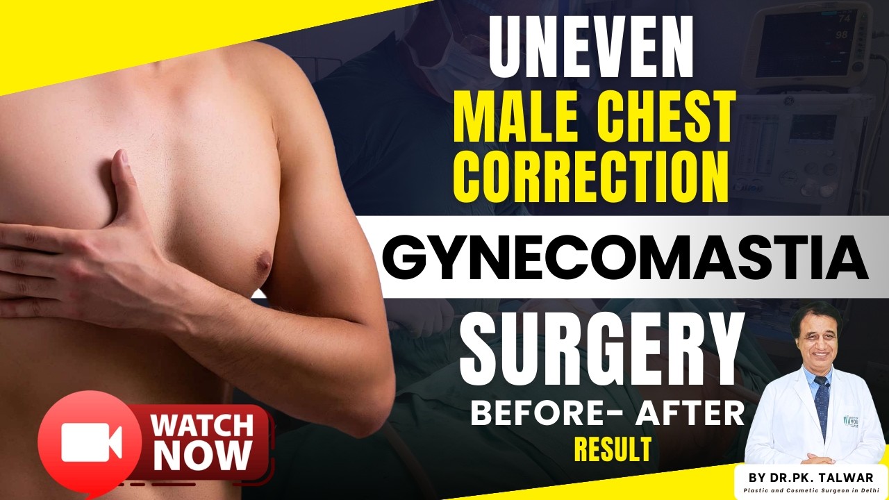 Asymmetry Gynecomastia Surgery Before After | Dr. PK Talwar 
