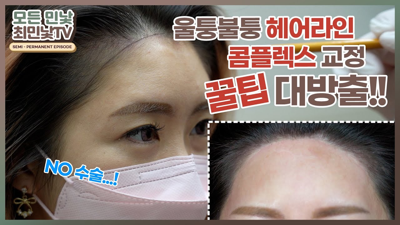 수술 없이 헤어라인 교정 가능🤔❓ 동그란 헤어라인 만드는 꿀팁 얻고 싶으면 시청 GOGO 💨│민낯뷰티아카데미