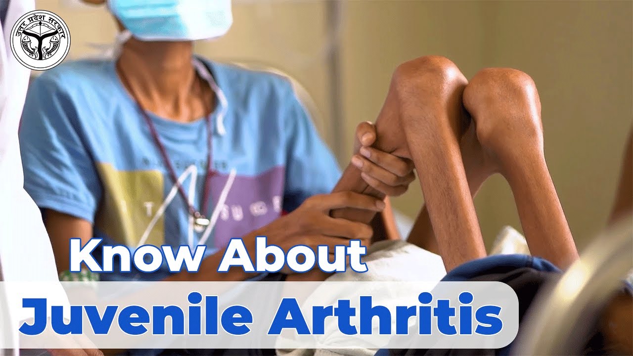 Juvenile Arthritis (गठिया) | Immunology & Rheumatology | SGPGI Lucknow | Medical Education, UP