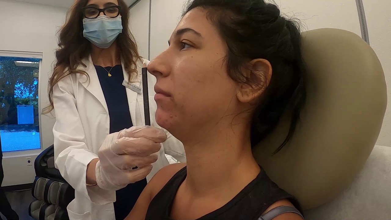Chin Filler
