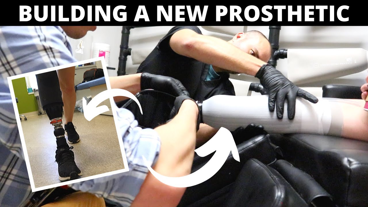 Build My PROSTHETIC LEG With Me!!