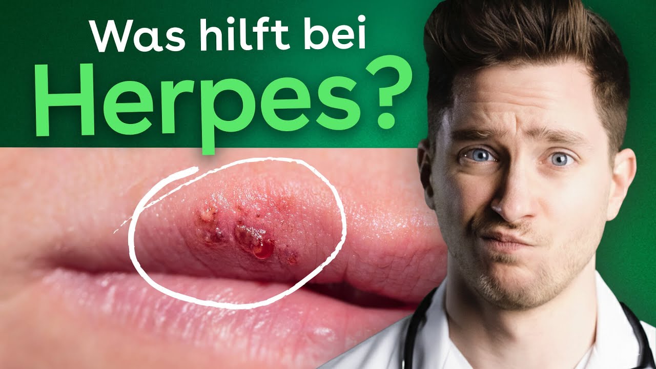 Herpes erklärt: Deshalb kommt er immer wieder zurück