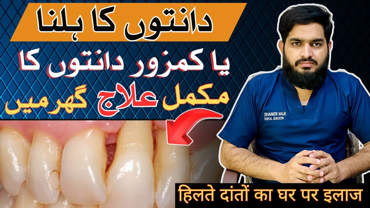 Home remedy for Loose Teeth Treatment | دانت ہلنے کا بہترین گھریلو علاج in URDU/HINDI ​⁠