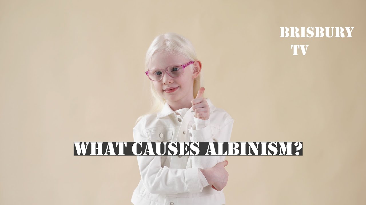 What Causes Albinism?