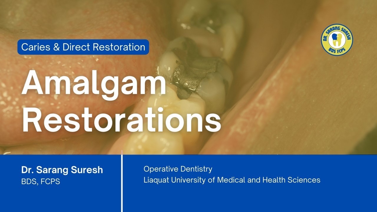 Amalgam Cavity Design: 90° Margins, Resistance & Retention Forms (Lecture 5)