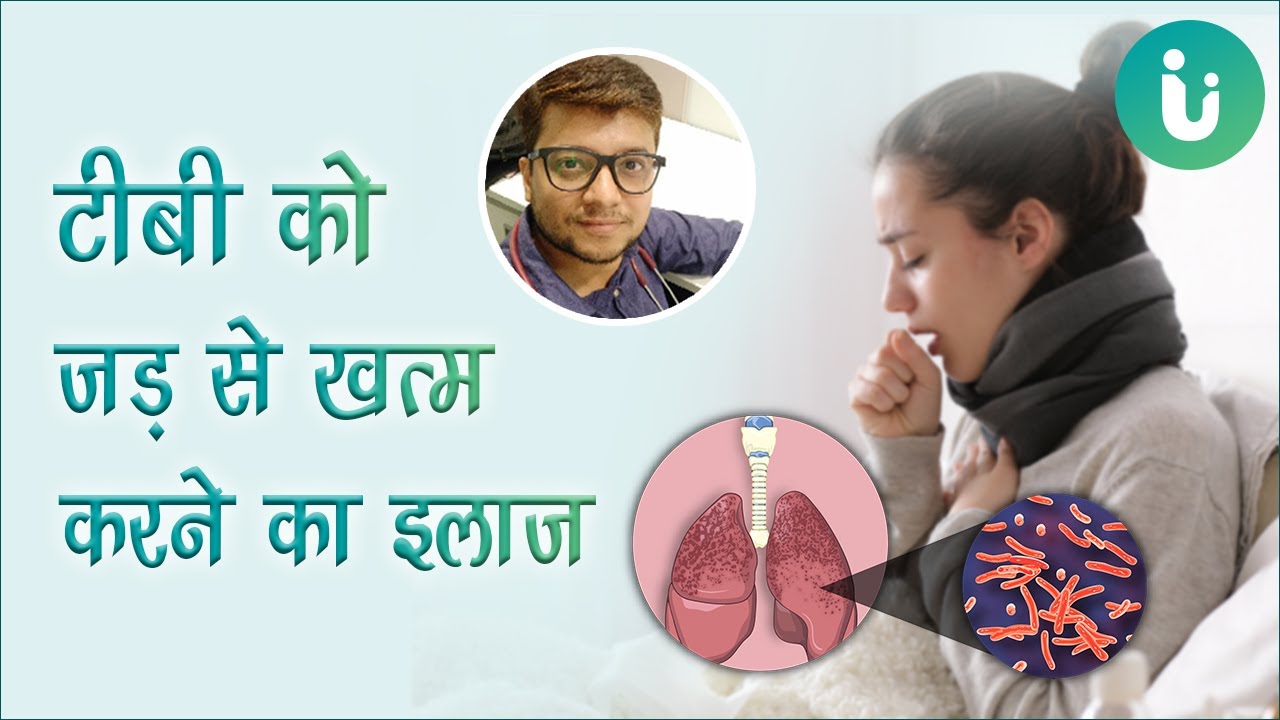 टीबी के लक्षण, कारण, इलाज, उपचार, दवा - Tuberculosis causes, symptoms, treatment, medicine in hindi