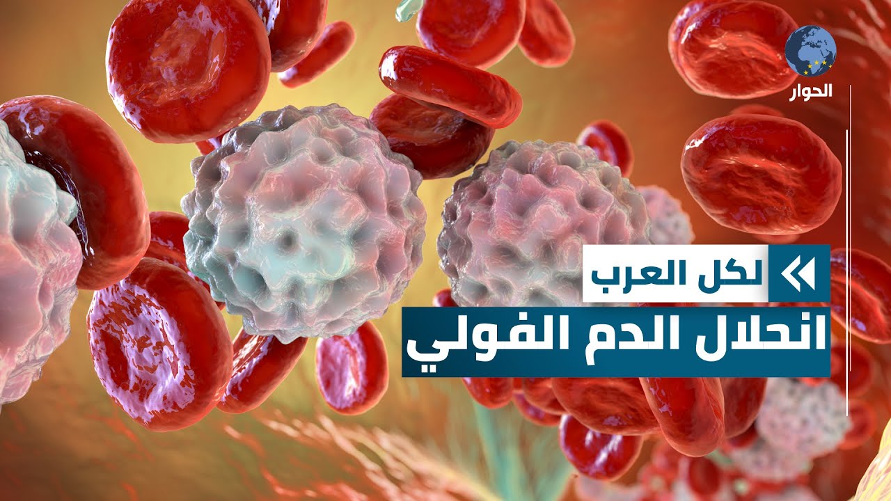 من أمراض الدم الوراثية.. معلومات قد تهمك عن مرض 