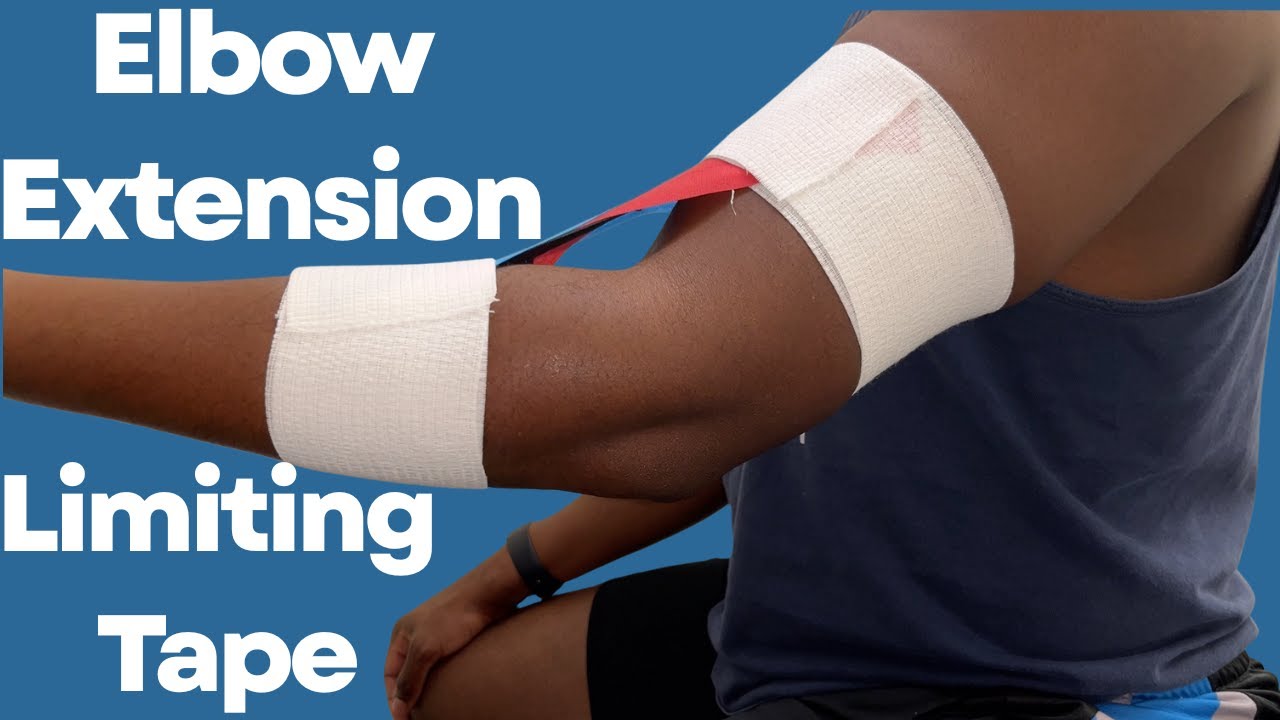 Elbow Extension Limiting Taping | Step-by-Step Guide