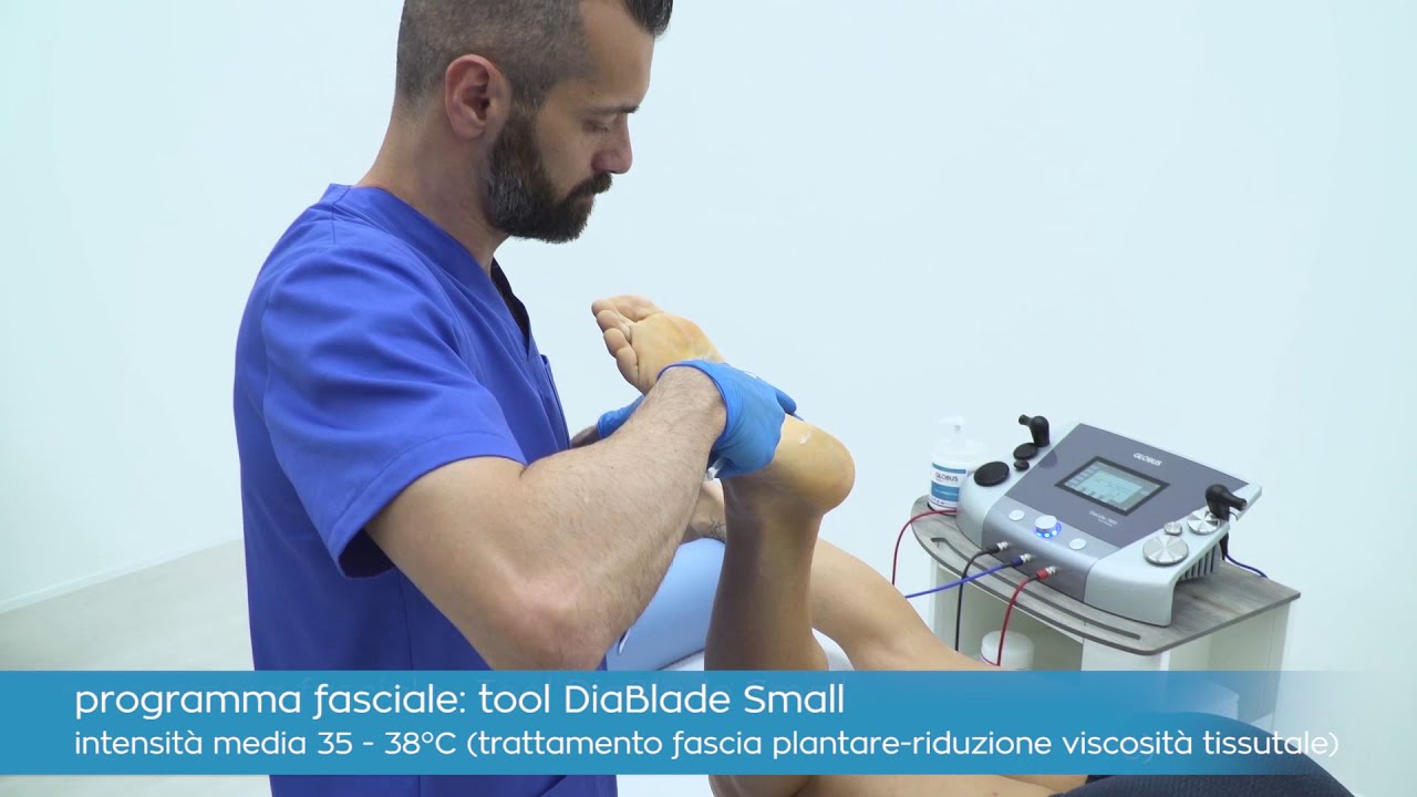 Fascite plantare: trattamenti miofasciali con la tecarterapia GLOBUS