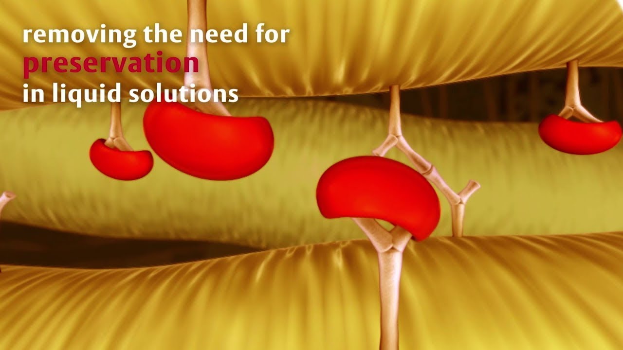 Edwards INSPIRIS RESILIA Aortic Valve