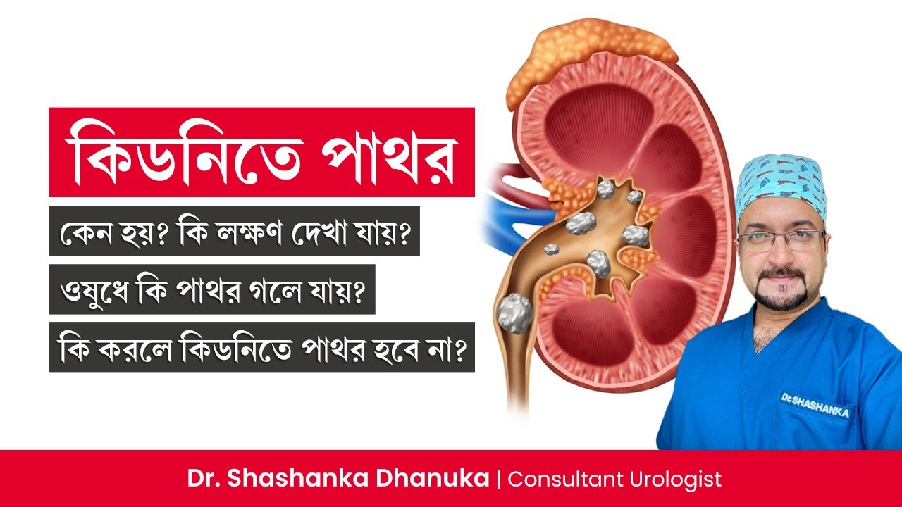 কিডনিতে পাথরঃ কারণ, লক্ষণ ও চিকিৎসা | Kidney Stone: Causes, Symptoms, Treatment & Prevention