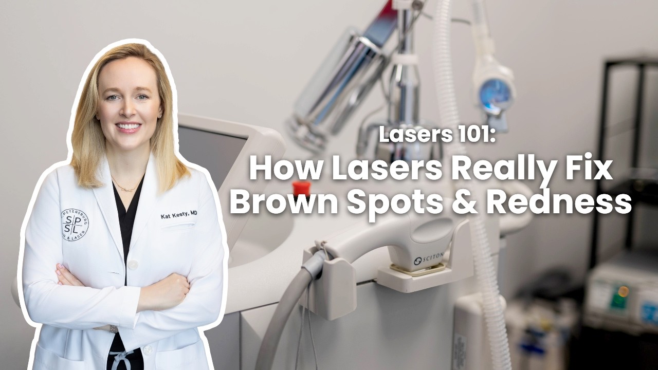 Lasers 101: How Lasers Really Fix Brown Spots and Redness