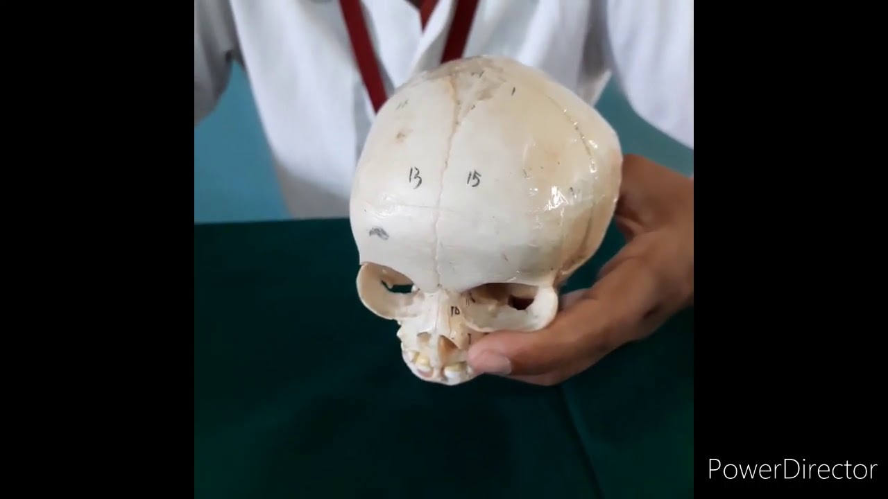 EXPLANATION OF  FETAL SKULL
