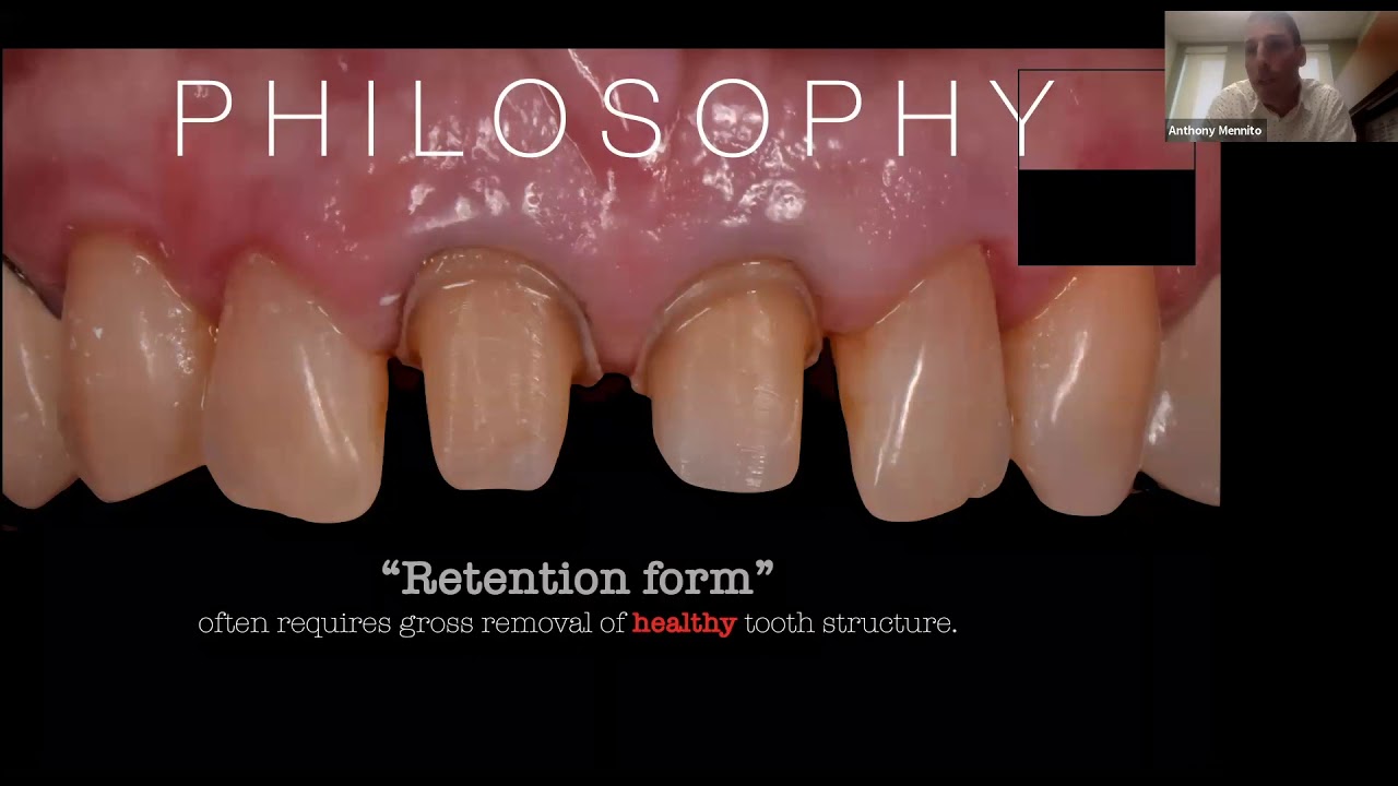Save the Enamel: Utilizing CAD/CAM for Partial Coverage Restorations with Dr. Anthony Mennito