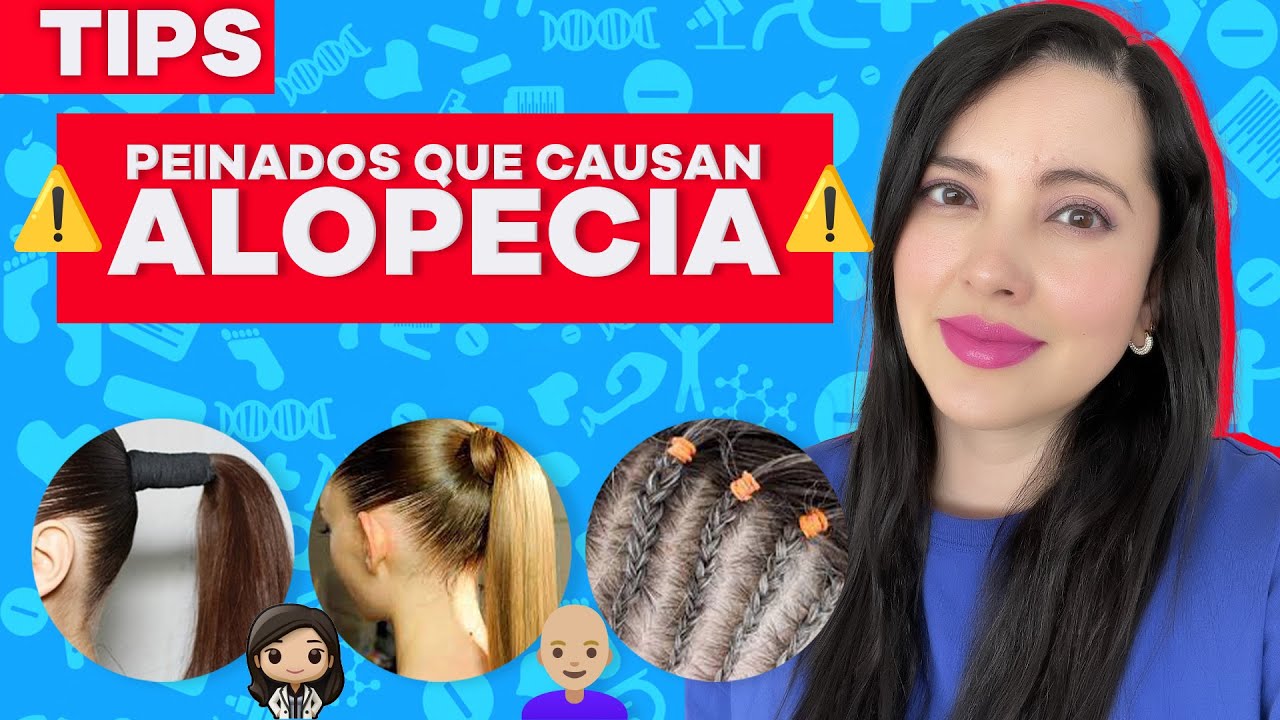 Caída de cabello por peinados  ALOPECIA POR TRACCIÓN 😱