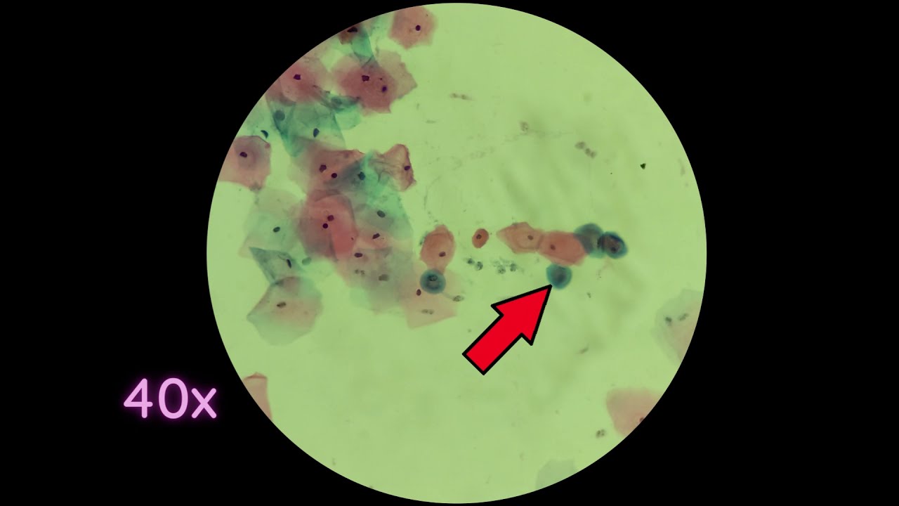 Extendido cérvico vaginal - Práctico n° 1 - Video 1